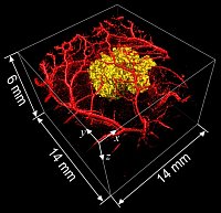 PA image of a melanin expressing tumour and the surrounding normal vasculature.