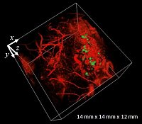 Photoacoustic image of the vasculature of a subcutaneous tumor. The tumor cells express a photoswitchable protein (green) and its spatial distribution can be detected by photoacoustic imaging.